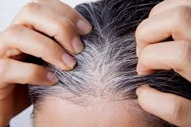 8 أسباب تؤدي لظهور الشعر الأبيض في سن مبكر