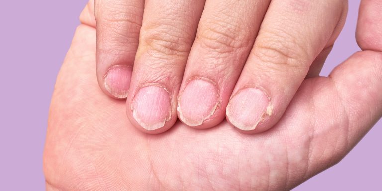 كيف تحافظين على صحة وجمال الأظافر خلال فصل الشتاء