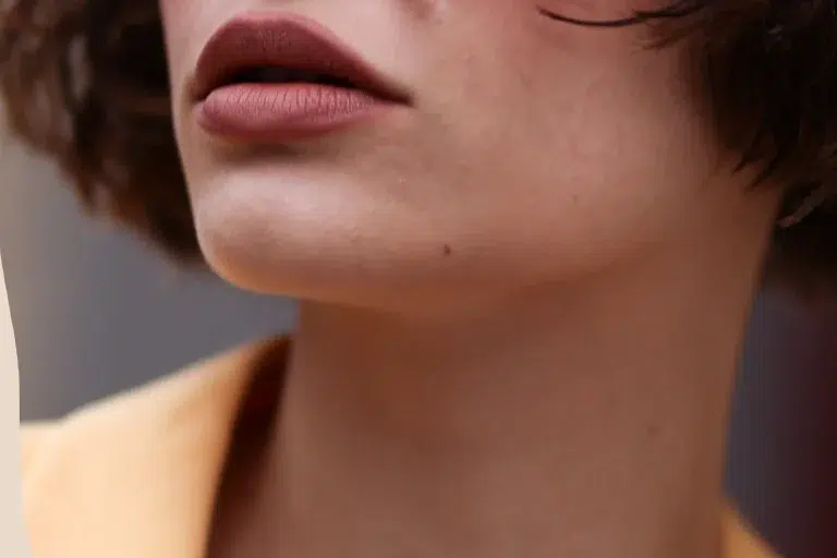 ما هي أسباب ظهور شعر الذقن لدى النساء؟
