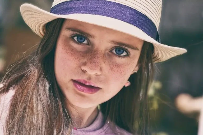 علاجات منزلية للتخلص من نمش الوجه